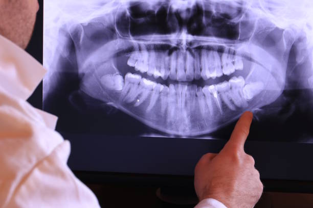 Best Cosmetic Emergency Dentistry in Williamston, SC